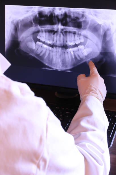 Best Emergency Tooth Extraction in Argentine, MI