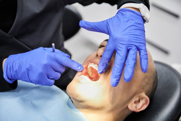Best Emergency Root Canal Treatment in Argentine, MI